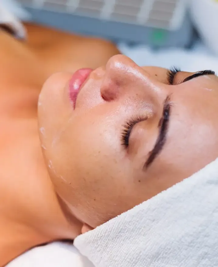 Pele com acne em avaliação para tratamento dermatológico
