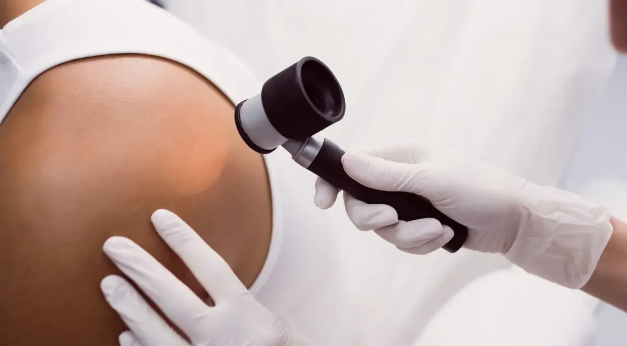 Dermatoscopia realizada durante consulta dermatológica Dermatoscopia realizada durante consulta dermatológica