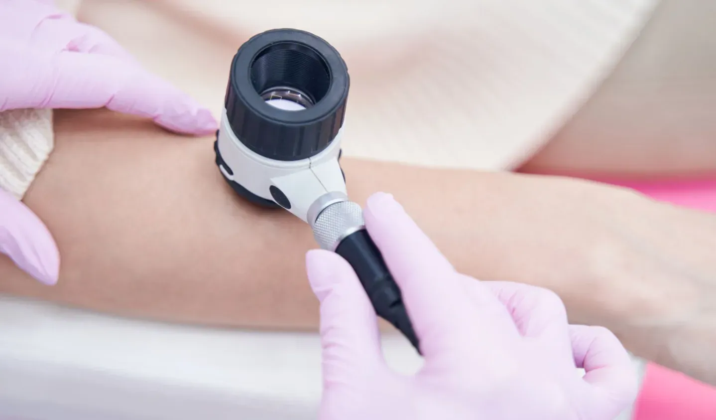 Detalhe de dermatoscopia Detalhe de dermatoscopia