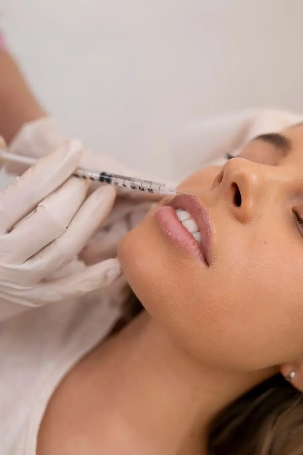 Aplicação de preenchimento labial com ácido hialurônico