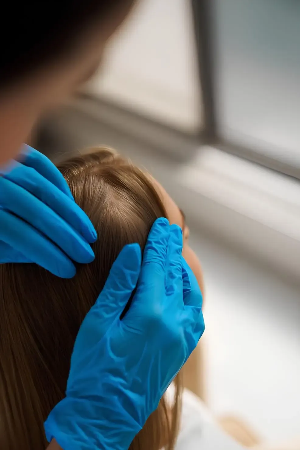 Avaliação do couro cabeludo em consulta dermatológica