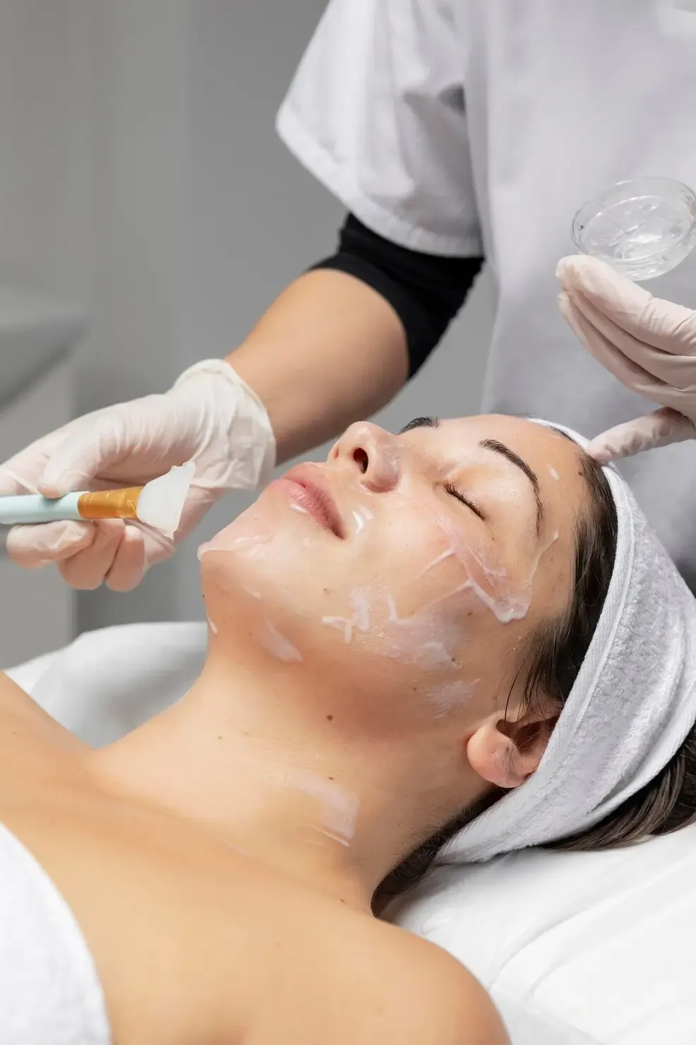 Aplicação de procedimento dermatológico para tratamento de melasma