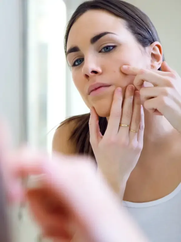 Exame da pele para avaliação dos sinais de acne
