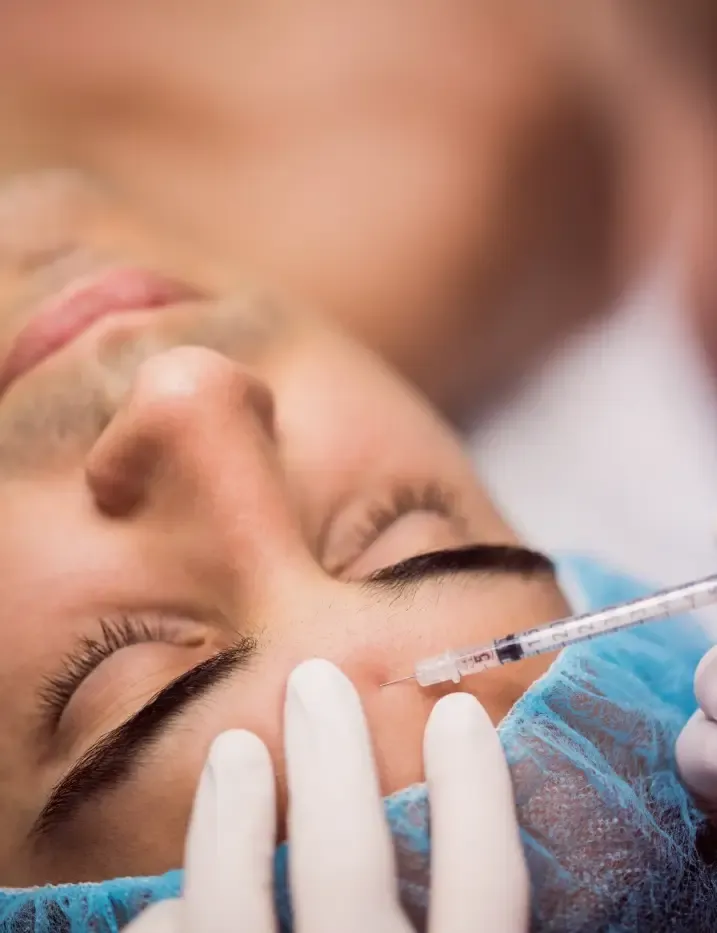 Aplicação de skinbooster para revitalização da pele em Ribeirão Preto